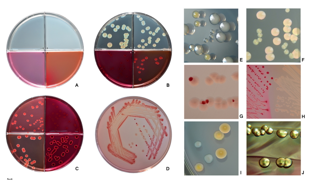 E.coli on growing on various agar media kicsi